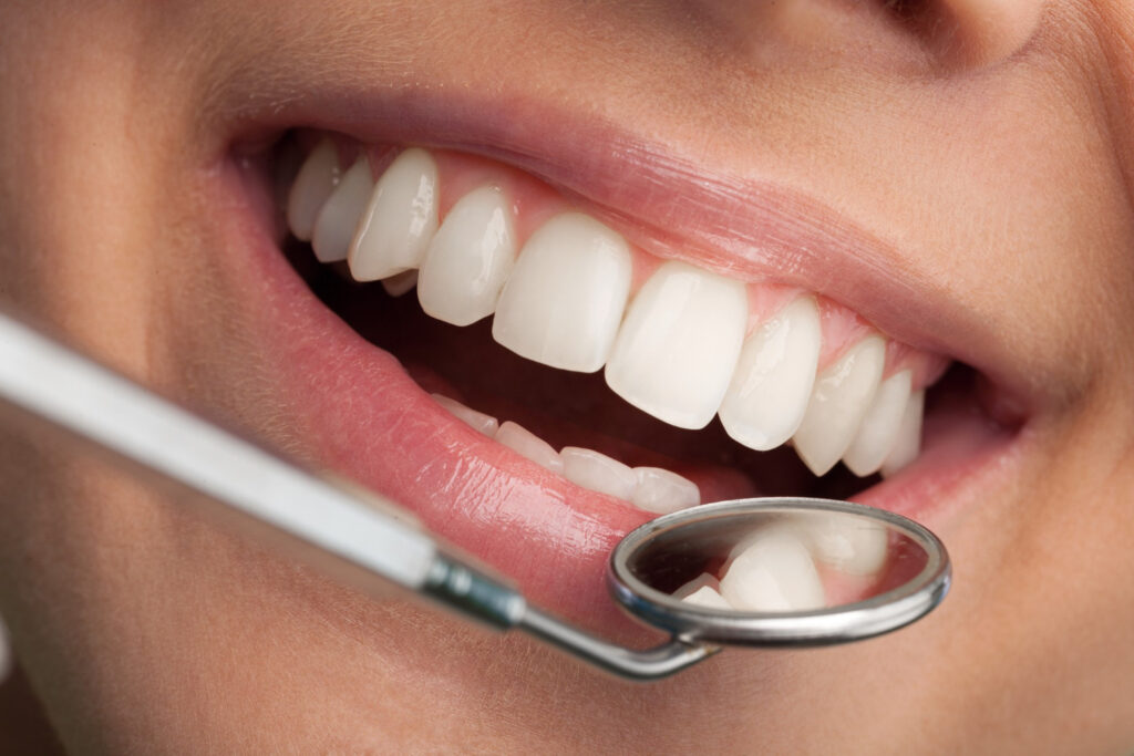 The Secret to a Hollywood Smile: How Smile Makeovers Can Transform Your Look