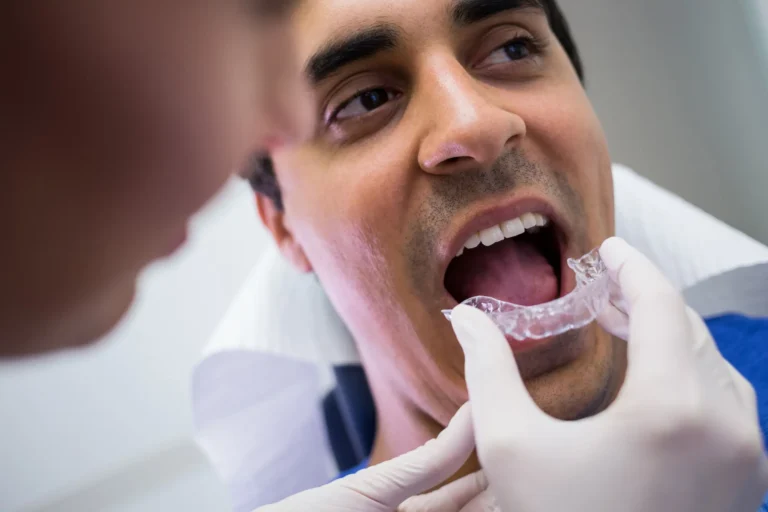 Clear Aligners in Dubai: The Discreet Way to Straighten Your Smile