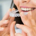 clear aligners treatment in UAE