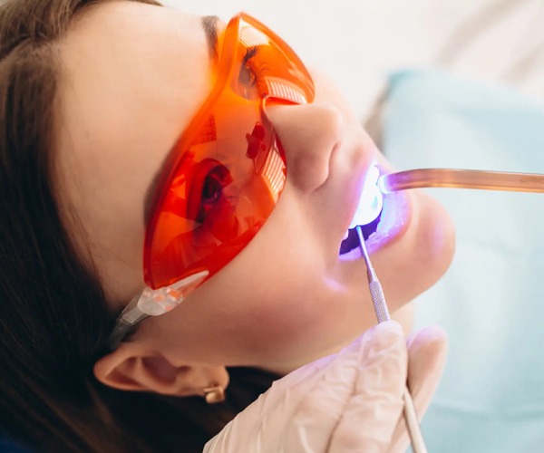 Laser gum treatments Dubai