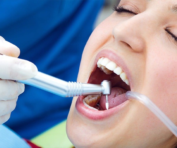 Root canal treatment uae