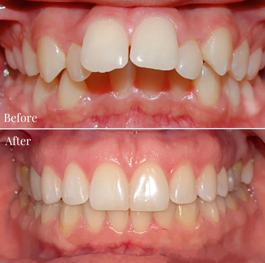 orthognathic surgery dubai