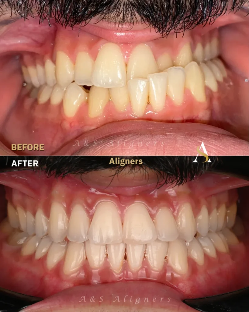 orthognathic surgery dubai
