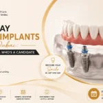 Same-Day Dental Implants in Dubai: How They Work & Who’s a Candidate