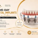 Same-Day Dental Implants in Dubai: How They Work & Who’s a Candidate