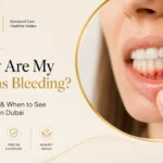 Why Are My Gums Bleeding? 7 Causes & When to See a Dentist in Dubai