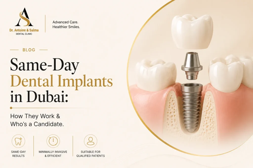 Same-Day Dental Implants in Dubai: How They Work & Who’s a Candidate