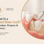What Is a Dental Bone Graft? Procedure, Purpose & Recovery