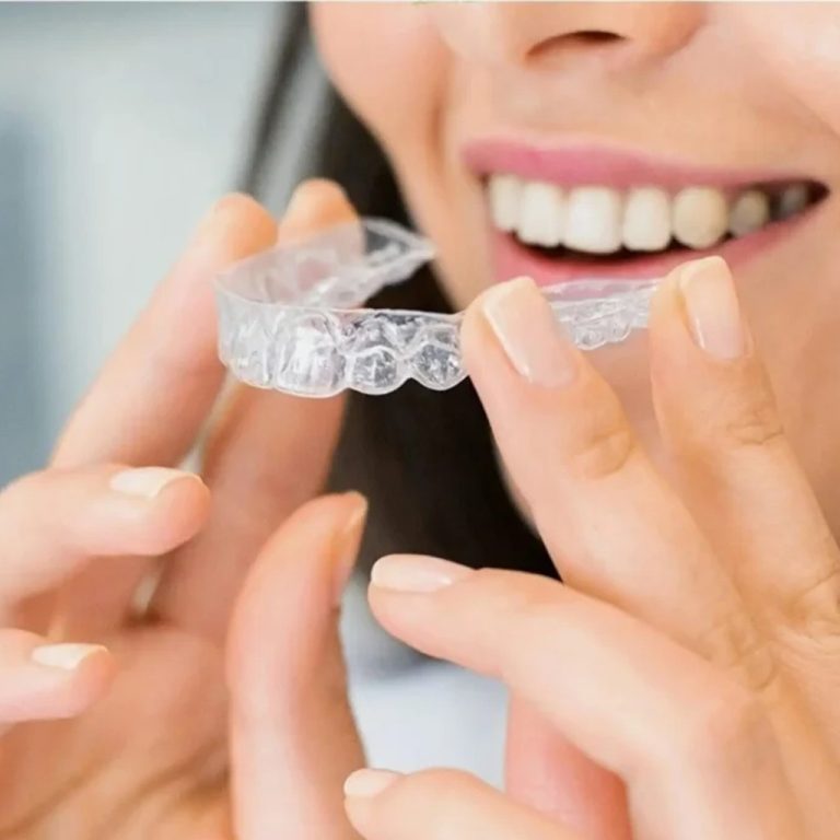 clear aligners treatment in UAE